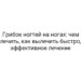Грибок ногтей на ногах: чем лечить, как вылечить быстро, эффективное лечение
